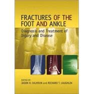 Fractures of the Foot and Ankle: Diagnosis and Treatment of Injury and Disease