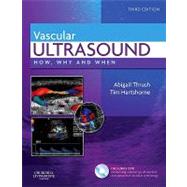 Vascular Ultrasound