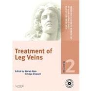 Treatment of Leg Veins