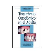 Tratamiento Ortodontico En El Adulto