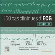 150 cas cliniques d'ECG - CAMPUS