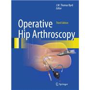 Operative Hip Arthroscopy