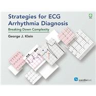 Strategies for ECG Arrhythmia Diagnosis