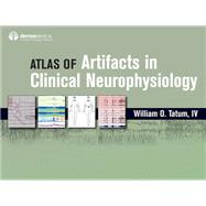 Atlas of Artifacts in Clinical Neurophysiology