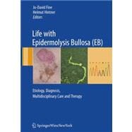 Life With Epidermolysis Bullosa Eb