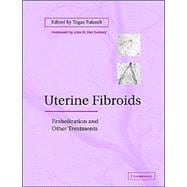 Uterine Fibroids: Embolization and other Treatments