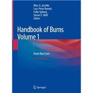 Handbook of Burns