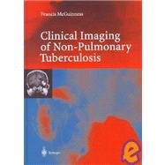 Clinical Imaging in Non-Pulmonary Tuberculosis