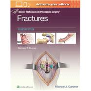 Master Techniques in Orthopaedic Surgery: Fractures