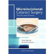 Microincisional Cataract Surgery The Art and Science