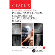 Clark’s Essential Guide to Preliminary Clinical Evaluation of Musculoskeletal X-rays