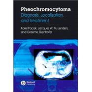 Pheochromocytoma Diagnosis, Localization, and Treatment