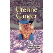 Uterine Cancer