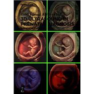 3D Ultrasound in Prenatal Diagnosis