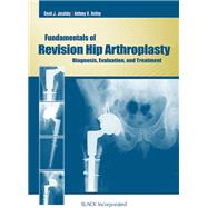 Fundamentals of Revision Hip Arthroplasty Diagnosis, Evaluation, and Treatment