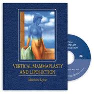 Vertical Mammaplasty and Liposuction/Book and Video