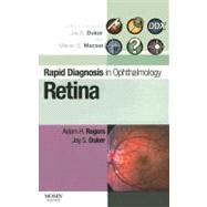 Retina