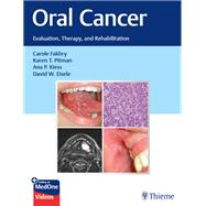 Oral Cancer