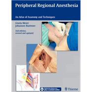 Peripheral Regional Anesthesia
