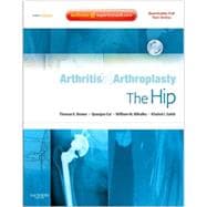 Arthritis & Arthroplasty