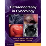 Ultrasonography in Gynecology