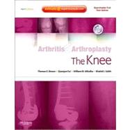 Arthritis & Arthroplasty: The Knee (Book with DVD + Access Code)