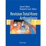 Revision Total Knee Arthroplasty