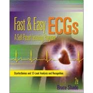 Fast and Easy ECGs: A Self-Paced Learning Program