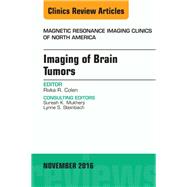 Imaging of Brain Tumors