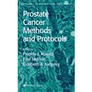 Prostate Cancermethods and Protocols