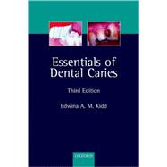 Essentials of Dental Caries The Disease and Its Management