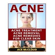 Acne: Acne Treatment- Acne Removal- Acne Remedies for Clear Skin