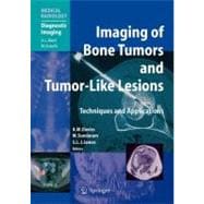 Imaging Bone Tumors and Tumor-Like Lesions