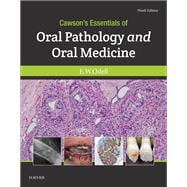 Cawson's Essentials of Oral Pathology and Oral Medicine