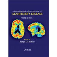 Clinical Diagnosis and Management of Alzheimer's Disease