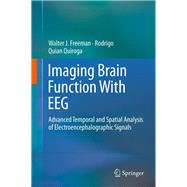 Imaging Brain Function With EEG