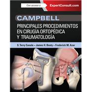 Campbell. Principales procedimientos en cirugía ortopédica y traumatología + ExpertConsult