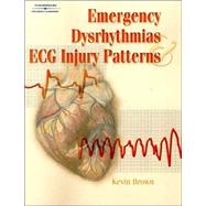 Emergency Dysrhythmias and Ecg Injury Patterns
