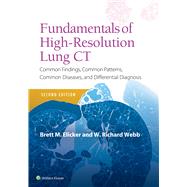 Fundamentals of High-Resolution Lung CT Common Findings, Common Patterns, Common Diseases and Differential Diagnosis