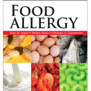 Food Allergy (Book with Access Code)